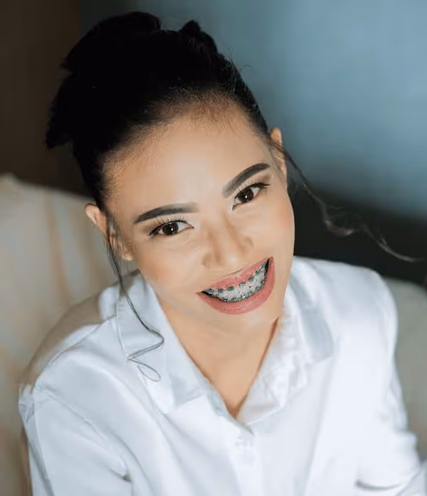 Dental Braces