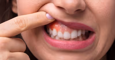What is Gum contouring