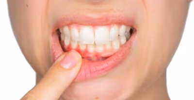 How to properly treat gum disease from diagnosis to treatment