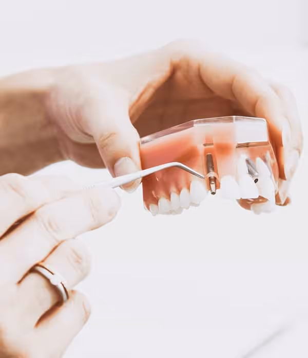 Dental Implant